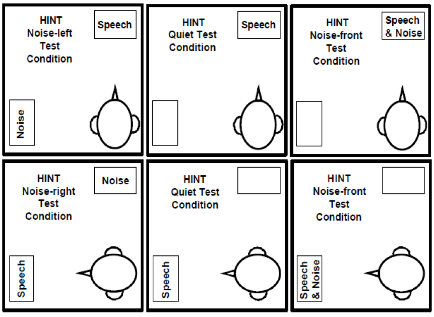 A study on the clinical usefulness and improvement of hearing in noise ...